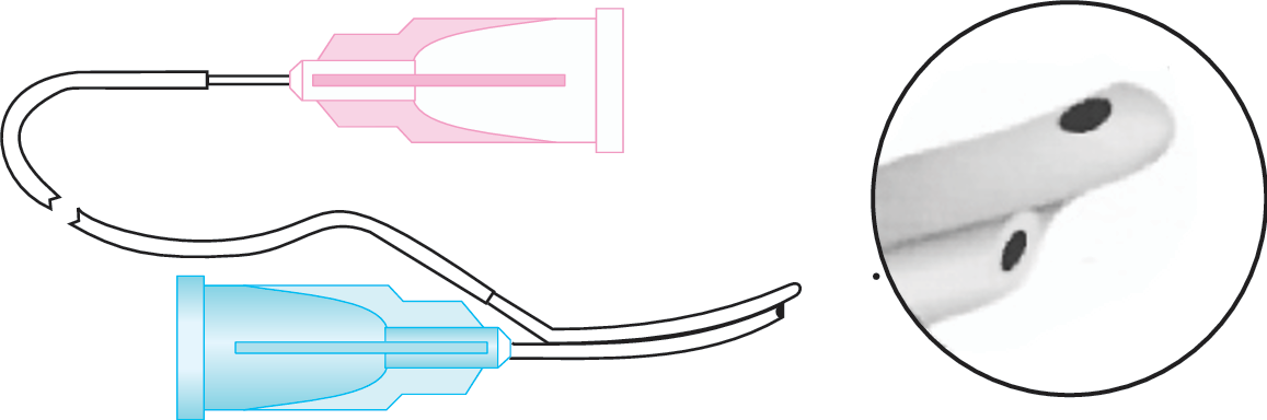 I & A Cannula (Simcoe Regular)